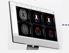 AI Powered Tool for the Early Diagnosis of Alzheimer's Disease - Seeking Experts in Germany and Singapore image