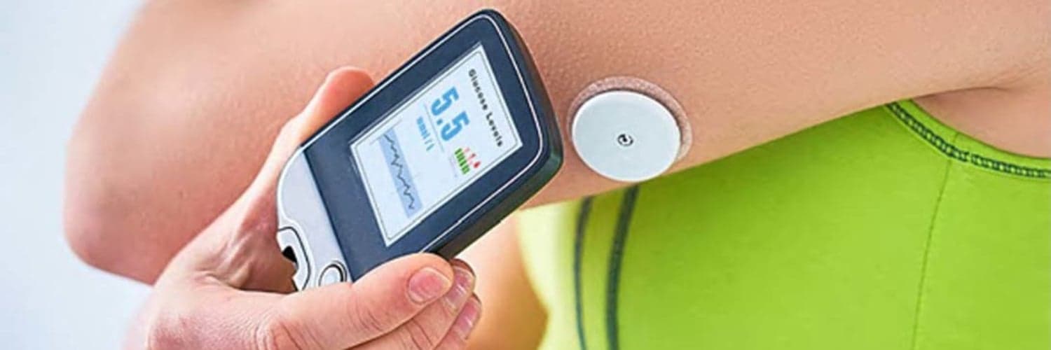 Continuous Glucose Monitoring Solution - Seeking Experts in China image