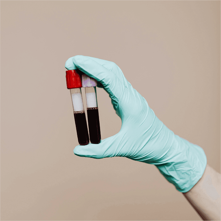Tech Scouting – Partner with a Global Diagnostics Leader on Alternative Blood Sampling Through VentureBlick image