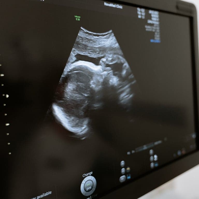 Survey - AI-Guided Neuraxial Ultrasound Positioning Tool - Seeking Experts in France, Germany and Netherlands image
