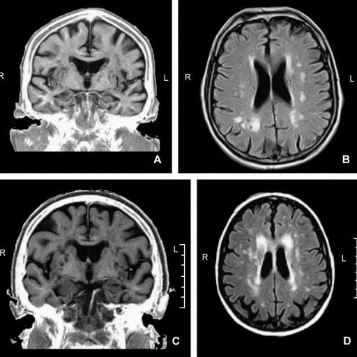 Survey - Digital Platform for Early Detection of Mild Cognitive Impairment – Seeking Experts in Germany image