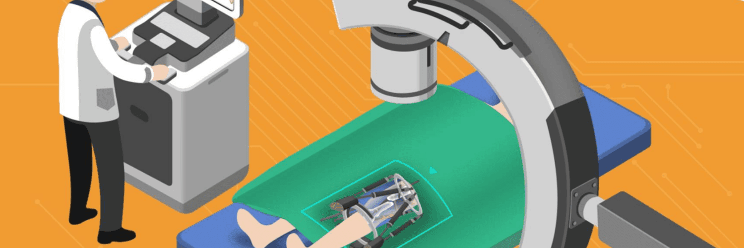 Robotic System for Fracture Surgery - Seeking Experts (Global) image