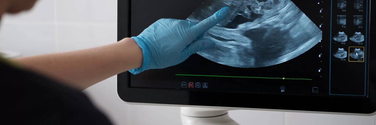 AI-Guided Neuraxial Ultrasound Positioning Tool - Seeking Experts in France, Germany and Netherlands image