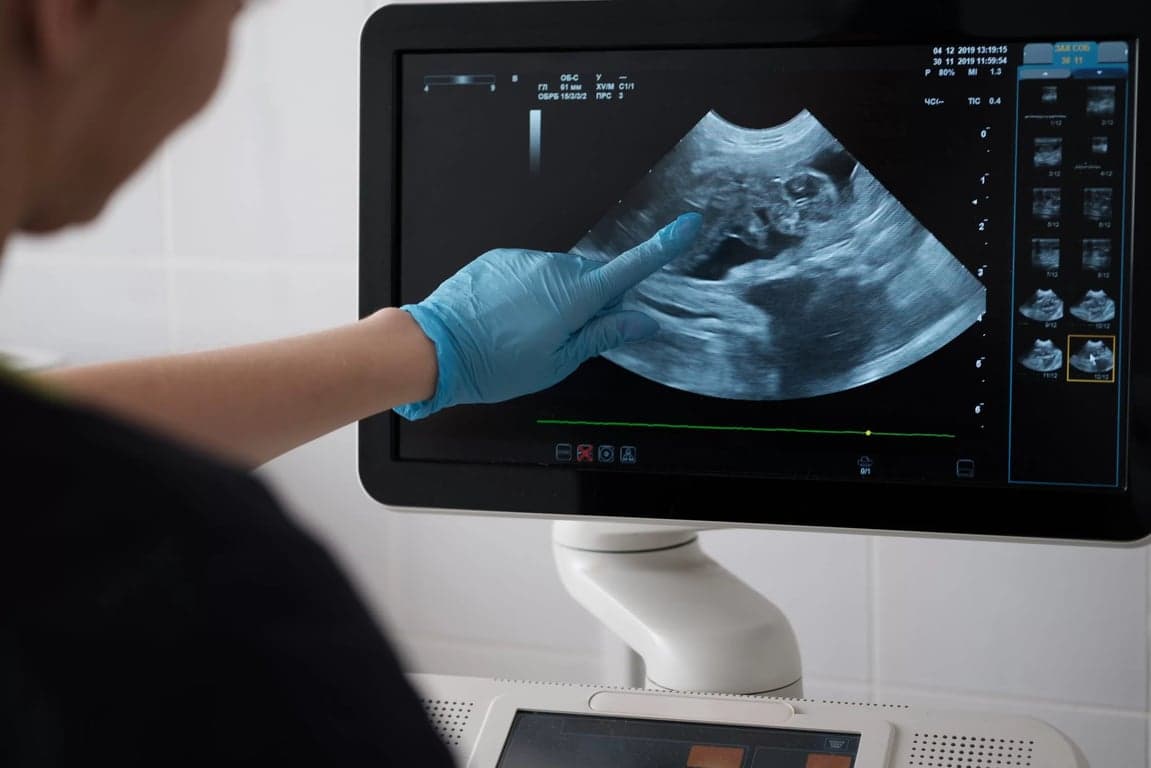 AI-Guided Neuraxial Ultrasound Positioning Tool - Seeking Experts in France, Germany and Netherlands image