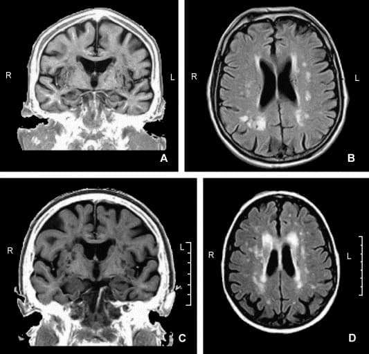Digital Platform for Early Detection of Mild Cognitive Impairment – Seeking Experts in Germany image