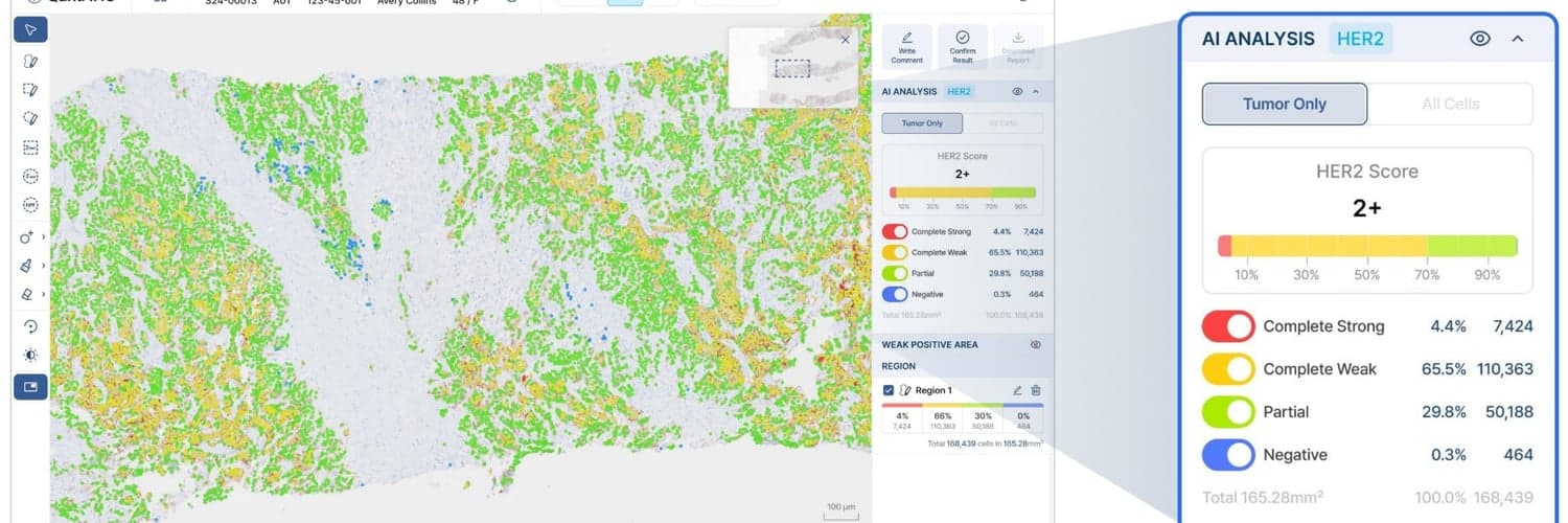 AI Powered Computational Pathology for Precision Cancer Therapy- Seeking Experts in Southeast Asia image