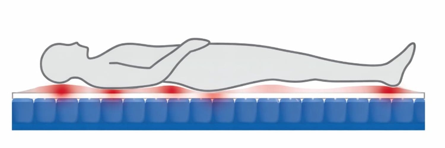 Smart Cushion and Mattress for Preventing Pressure Ulcers – Seeking Experts in Southeast Asia image