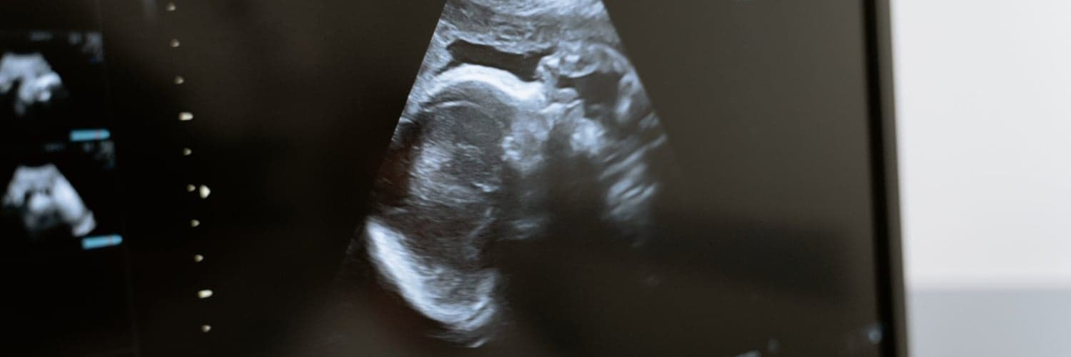 Survey - AI-Guided Neuraxial Ultrasound Positioning Tool - Seeking Experts in France, Germany and Netherlands image