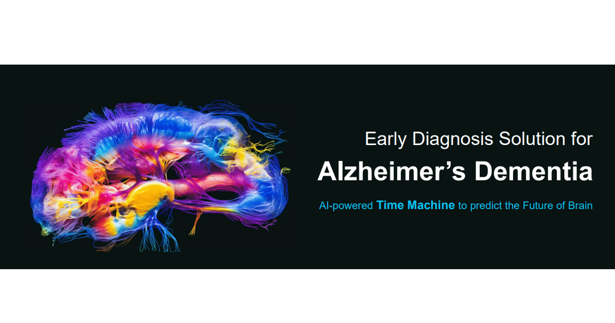AI Powered Tool for the Early Diagnosis of Alzheimer's Disea
